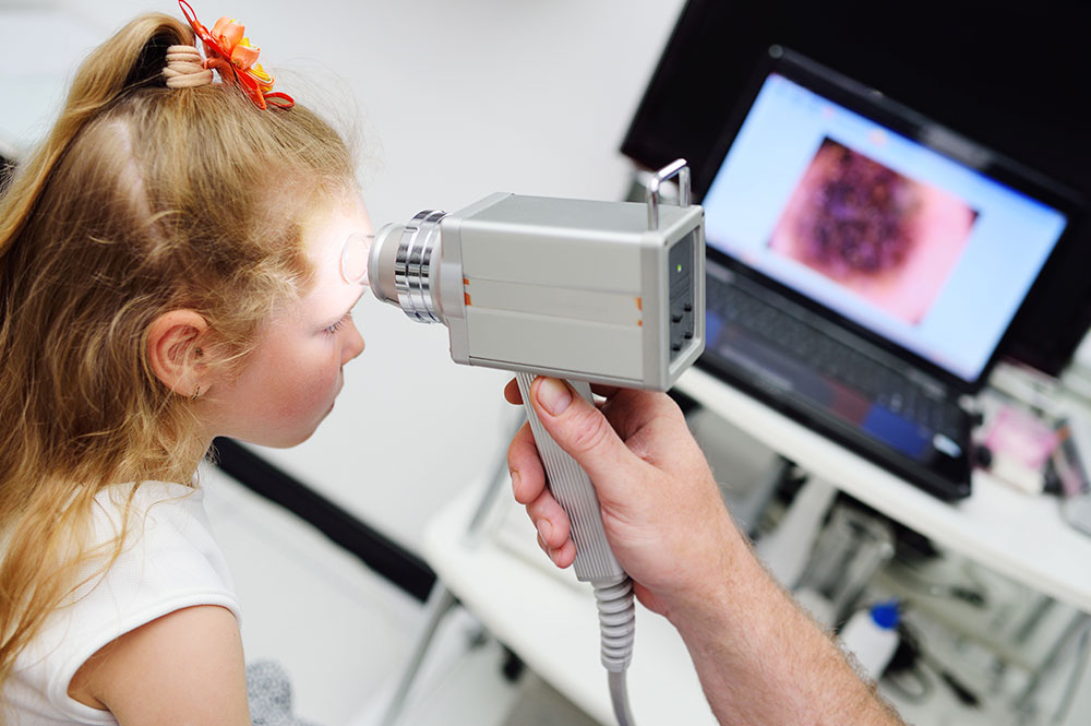 Dermatoscopia-digital Tratamento de manchas na pele